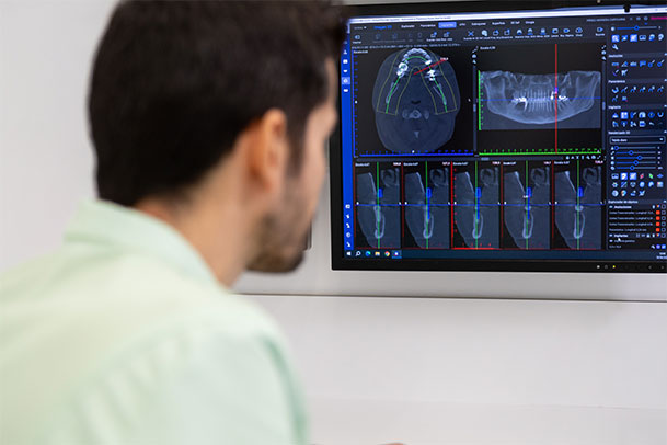 tecnologia centro dental avanzado alcorcon