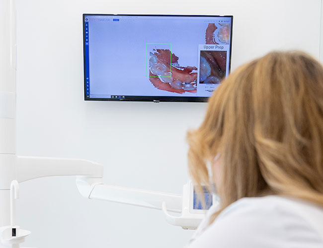 estudio periodontal en Alcorcón con escáner intraoral