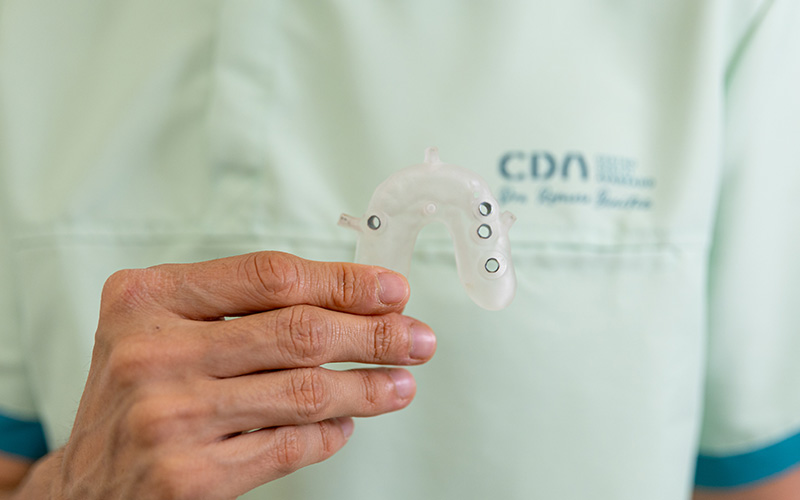 ferula cirugia guiada