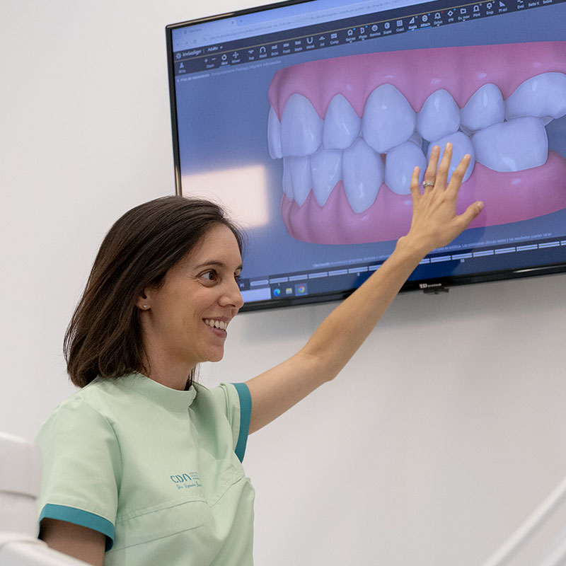 clincheck ortodoncia invisible, escaner itero