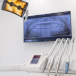 Adiós a los moldes de pasta: así es el escáner intraoral 3D en CDA Alcorcón