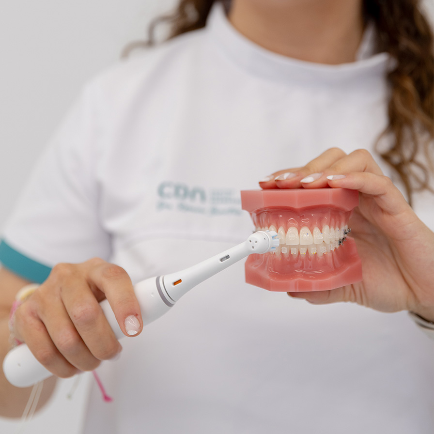 limpieza dental en alcorcon