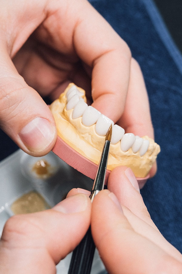 Prótesis dental removible en Alcorcón