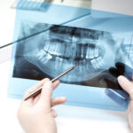 TAC Dental 3D en Alcorcón: diagnóstico de precisión antes de tocar un solo diente